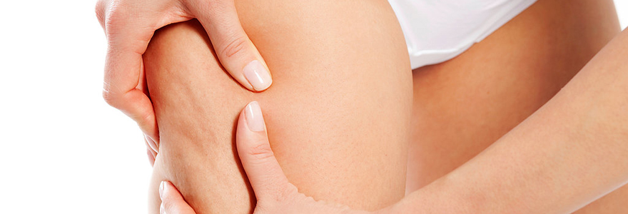 se débarrasser de la cellulite